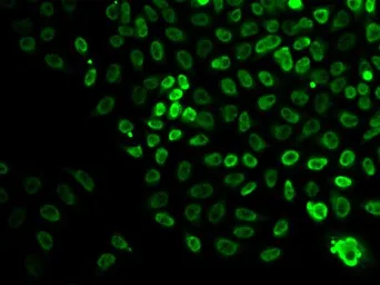 Anti-BRG1 antibody used in Immunocytochemistry/ Immunofluorescence (ICC/IF). GTX35204