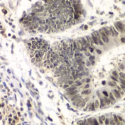 Anti-BRG1 antibody used in IHC (Paraffin sections) (IHC-P). GTX35204