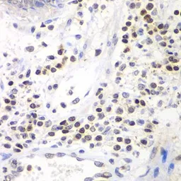 Anti-BRG1 antibody used in IHC (Paraffin sections) (IHC-P). GTX35204