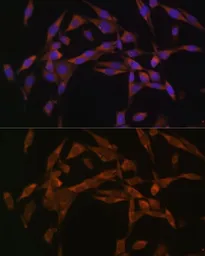 Anti-UBE2O antibody used in Immunocytochemistry/ Immunofluorescence (ICC/IF). GTX35205