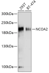 Anti-NCOA2 antibody used in Western Blot (WB). GTX35206