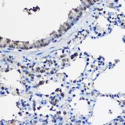 Anti-NCOA2 antibody used in IHC (Paraffin sections) (IHC-P). GTX35206
