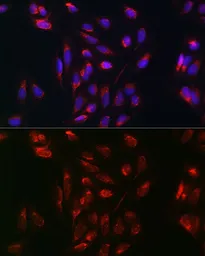 Anti-RAB5A antibody used in Immunocytochemistry/ Immunofluorescence (ICC/IF). GTX35207