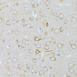 Anti-MEK1 antibody used in IHC (Paraffin sections) (IHC-P). GTX35212