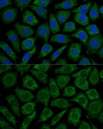 Anti-NDUFS2 antibody used in Immunocytochemistry/ Immunofluorescence (ICC/IF). GTX35213