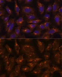 Anti-IFITM3 antibody used in Immunocytochemistry/ Immunofluorescence (ICC/IF). GTX35214