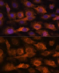 Anti-IFITM3 antibody used in Immunocytochemistry/ Immunofluorescence (ICC/IF). GTX35214