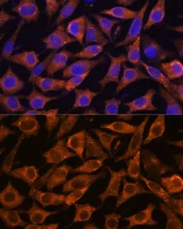 Anti-IFITM3 antibody used in Immunocytochemistry/ Immunofluorescence (ICC/IF). GTX35214
