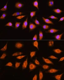 Anti-GNAI3 antibody used in Immunocytochemistry/ Immunofluorescence (ICC/IF). GTX35215
