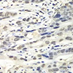 Anti-MTH1 antibody used in IHC (Paraffin sections) (IHC-P). GTX35216