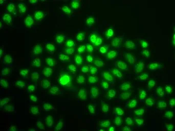 Anti-BAF57 antibody used in Immunocytochemistry/ Immunofluorescence (ICC/IF). GTX35217