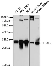 Anti-Galectin 3 antibody used in Western Blot (WB). GTX35218