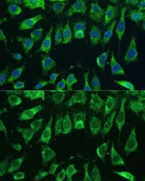 Anti-Galectin 3 antibody used in Immunocytochemistry/ Immunofluorescence (ICC/IF). GTX35218