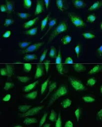 Anti-Galectin 3 antibody used in Immunocytochemistry/ Immunofluorescence (ICC/IF). GTX35218