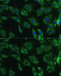 Anti-Galectin 3 antibody used in Immunocytochemistry/ Immunofluorescence (ICC/IF). GTX35218
