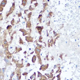 Anti-NDUFB4 antibody used in Immunocytochemistry/ Immunofluorescence (ICC/IF). GTX35219