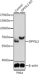 Anti-CRMP2 antibody used in Western Blot (WB). GTX35221