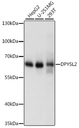 Anti-CRMP2 antibody used in Western Blot (WB). GTX35221