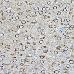 Anti-CRMP2 antibody used in IHC (Paraffin sections) (IHC-P). GTX35221