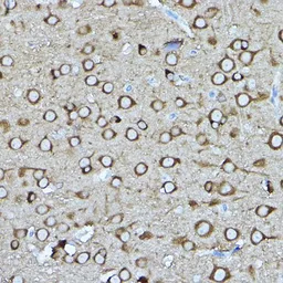 Anti-CRMP2 antibody used in IHC (Paraffin sections) (IHC-P). GTX35221