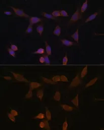 Anti-NDUFA5 antibody used in Immunocytochemistry/ Immunofluorescence (ICC/IF). GTX35222
