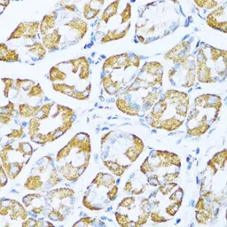 Anti-NDUFA5 antibody used in IHC (Paraffin sections) (IHC-P). GTX35222