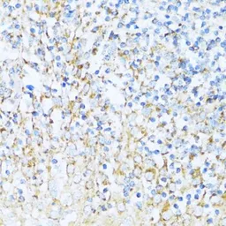 Anti-NDUFA5 antibody used in IHC (Paraffin sections) (IHC-P). GTX35222