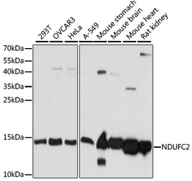 Anti-NDUFC2 antibody used in Western Blot (WB). GTX35226