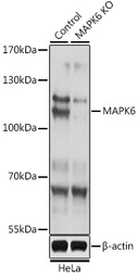 Anti-ERK3 antibody used in Western Blot (WB). GTX35227
