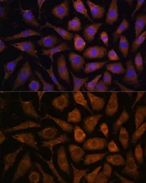 Anti-ERK3 antibody used in Immunocytochemistry/ Immunofluorescence (ICC/IF). GTX35227