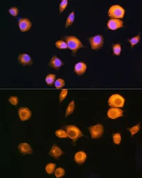 Anti-PKA R2 antibody used in Immunocytochemistry/ Immunofluorescence (ICC/IF). GTX35228