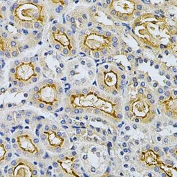 Anti-GRK2 antibody used in IHC (Paraffin sections) (IHC-P). GTX35230