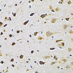 Anti-GRK2 antibody used in IHC (Paraffin sections) (IHC-P). GTX35230