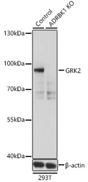 Anti-GRK2 antibody used in Western Blot (WB). GTX35230