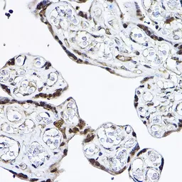 Anti-PDCD4 antibody used in IHC (Paraffin sections) (IHC-P). GTX35232