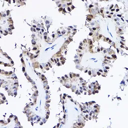 Anti-PDCD4 antibody used in IHC (Paraffin sections) (IHC-P). GTX35232