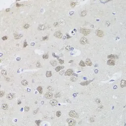 Anti-PP1C gamma antibody used in IHC (Paraffin sections) (IHC-P). GTX35235