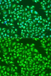 Anti-Integrin alpha 2 antibody used in Immunocytochemistry/ Immunofluorescence (ICC/IF). GTX35237