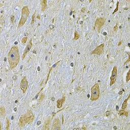 Anti-Integrin alpha 2 antibody used in IHC (Paraffin sections) (IHC-P). GTX35237