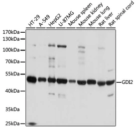 Anti-GDI2 antibody used in Western Blot (WB). GTX35241