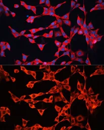 Anti-GDI2 antibody used in Immunocytochemistry/ Immunofluorescence (ICC/IF). GTX35241