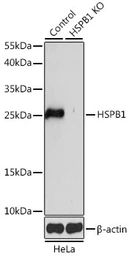 Anti-HSP27 antibody used in Western Blot (WB). GTX35243