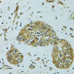 Anti-HSP27 antibody used in IHC (Paraffin sections) (IHC-P). GTX35243