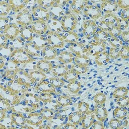 Anti-HSP27 antibody used in IHC (Paraffin sections) (IHC-P). GTX35243