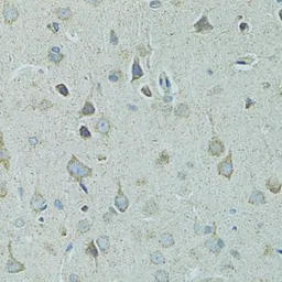 Anti-HSP27 antibody used in IHC (Paraffin sections) (IHC-P). GTX35243