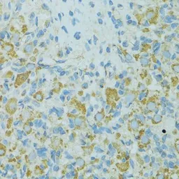 Anti-HSP27 antibody used in IHC (Paraffin sections) (IHC-P). GTX35243
