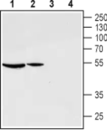 Anti-GnRHR antibody used in Western Blot (WB). GTX35245