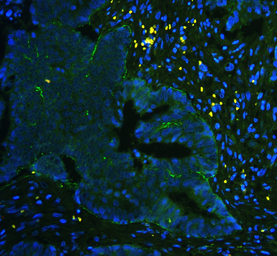 Anti-Integrin alpha 5 antibody used in IHC (Paraffin sections) (IHC-P). GTX35249