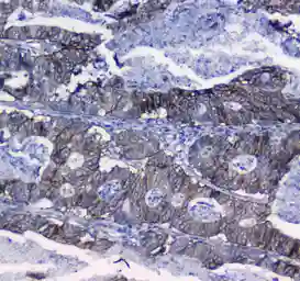 Anti-Integrin alpha 5 antibody used in IHC (Paraffin sections) (IHC-P). GTX35249
