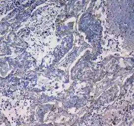 Anti-Integrin alpha 5 antibody used in IHC (Paraffin sections) (IHC-P). GTX35249